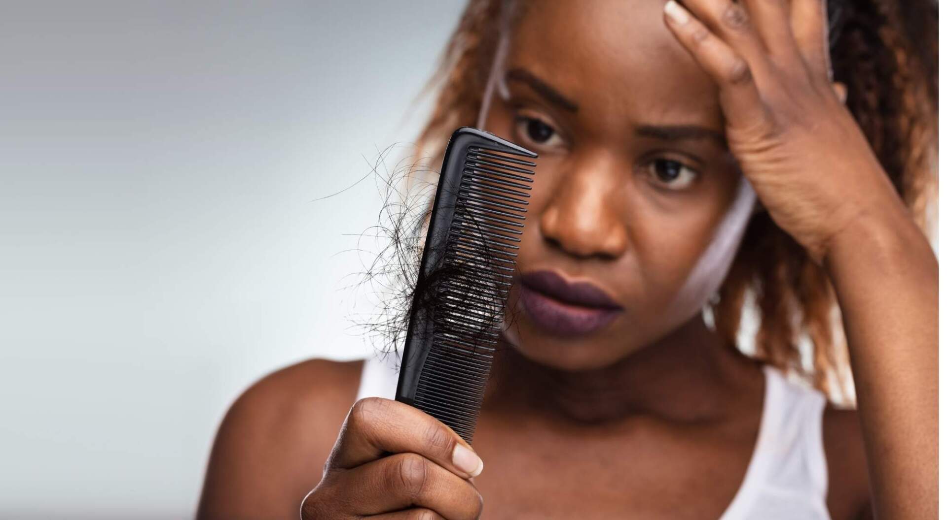 hair loss with hormone imbalance
