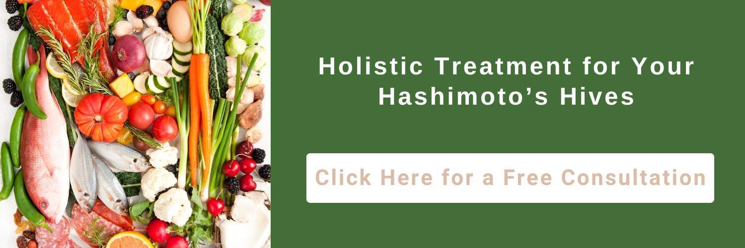 hashimoto's hives