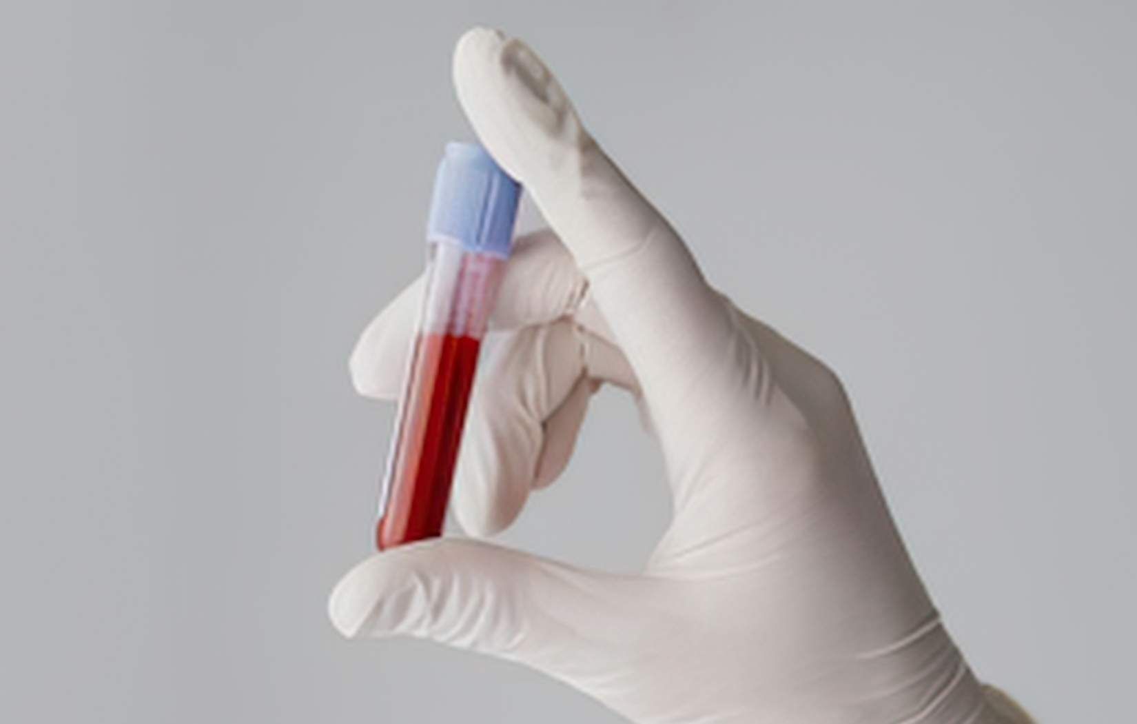 how often thyroid levels should be checked