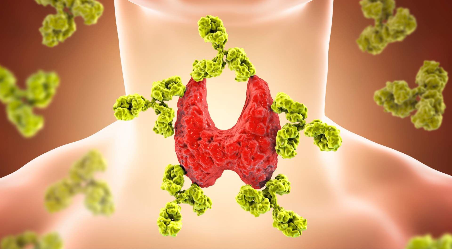 how to diagnose hashimoto's disease