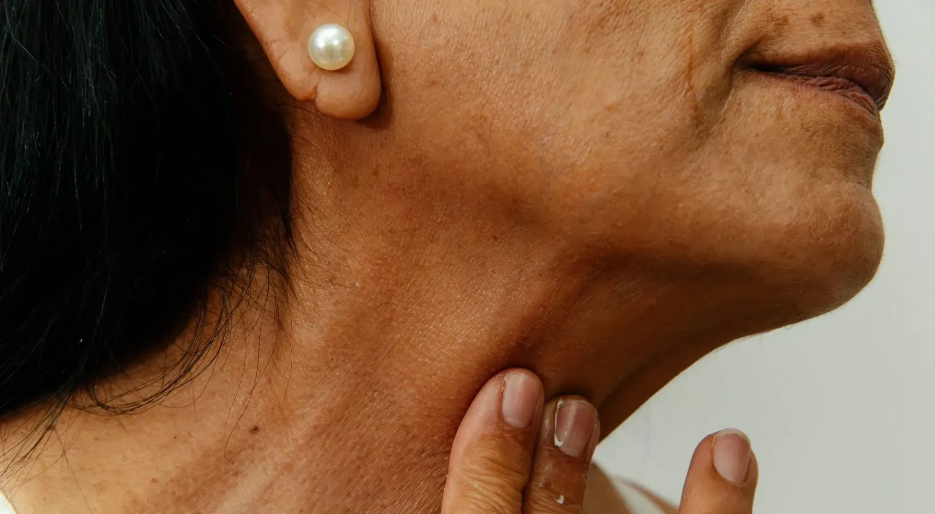 hypothyroidism nutririonist near brooklyn