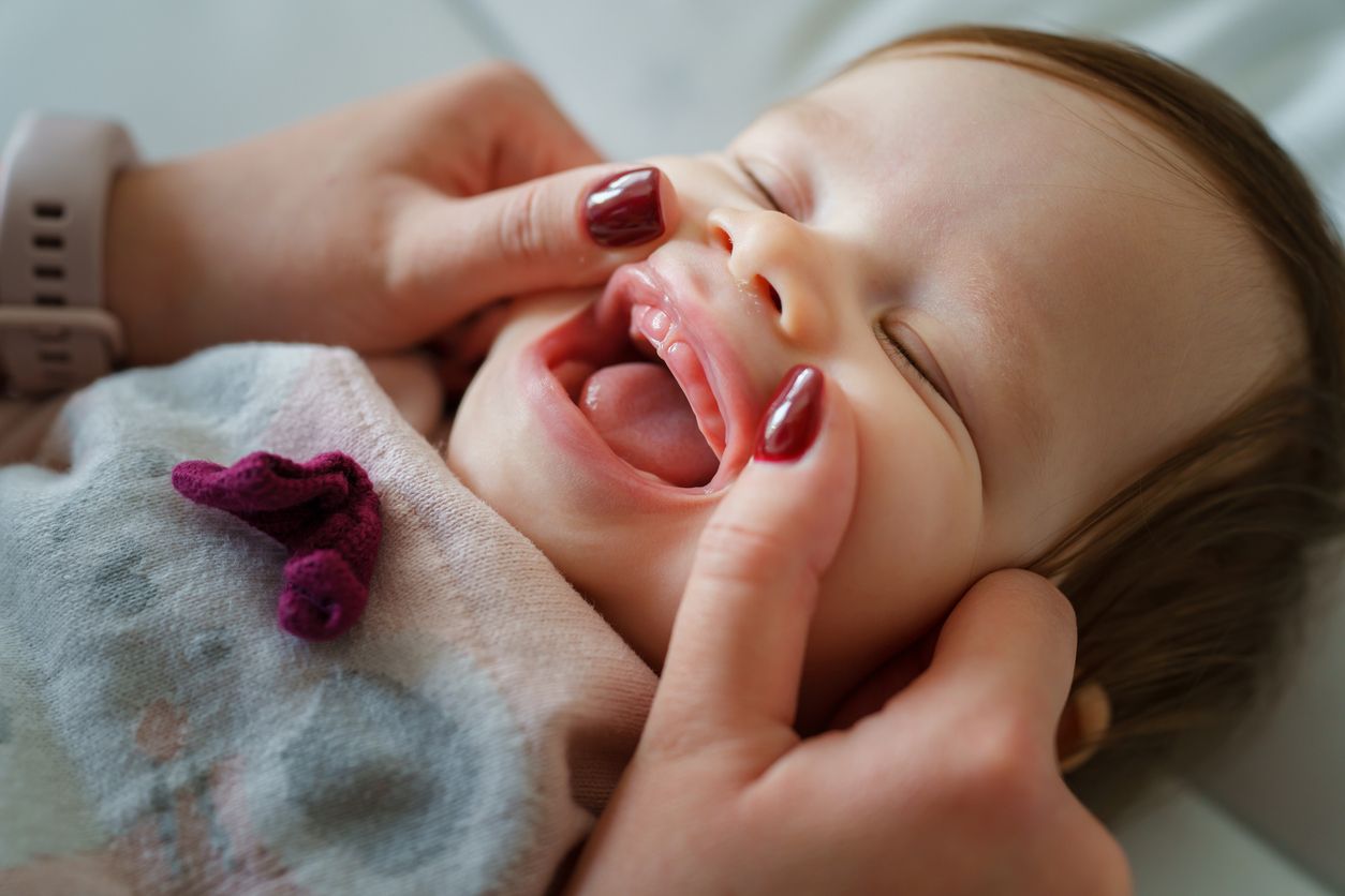 Close-up of a baby with mouth open, cheeks held by hands. Baby is lying down, eyes closed.
