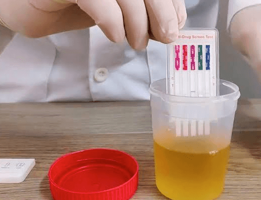 LABORATORIO CLÍNICO ADQ - Pruebas toxicológicas