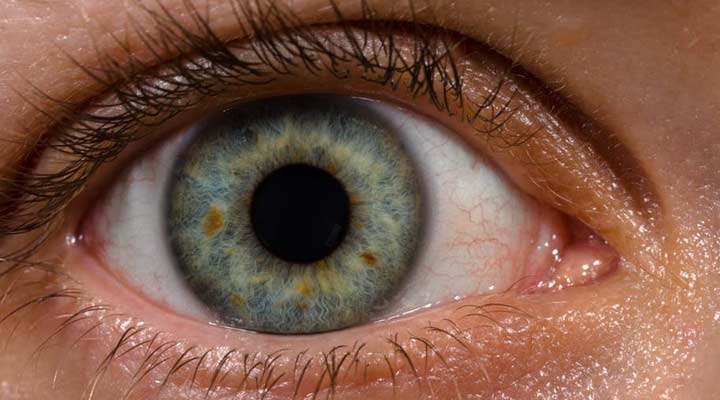 DR. LUIS OLMOS VALLADARES - Glaucoma