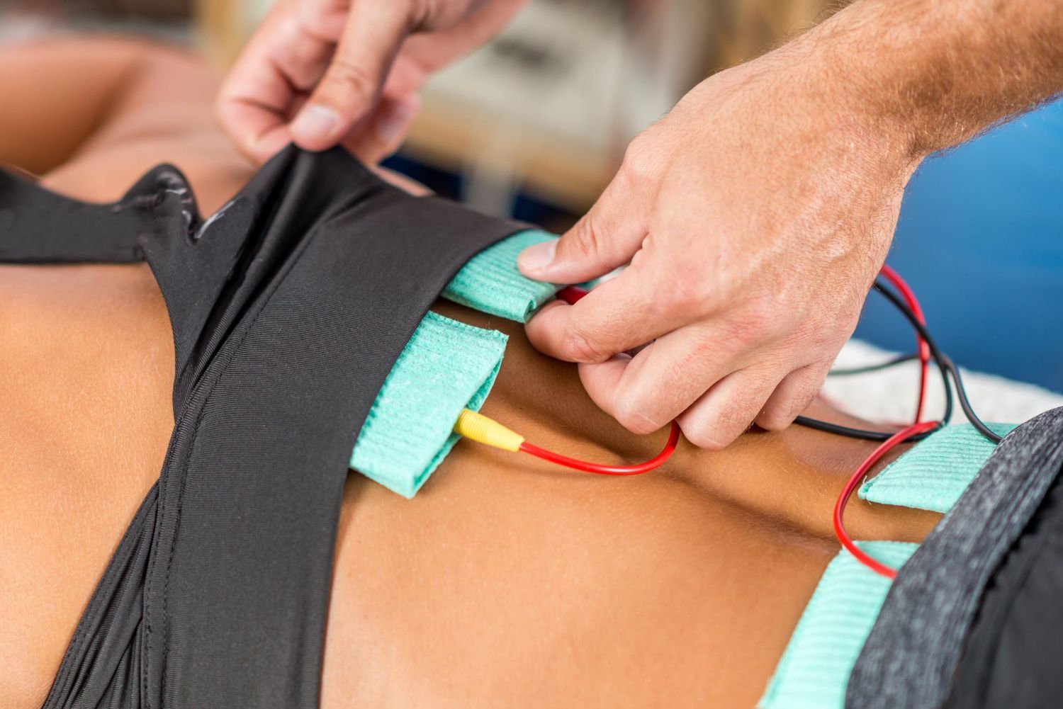 Spinal Cord Stimulators