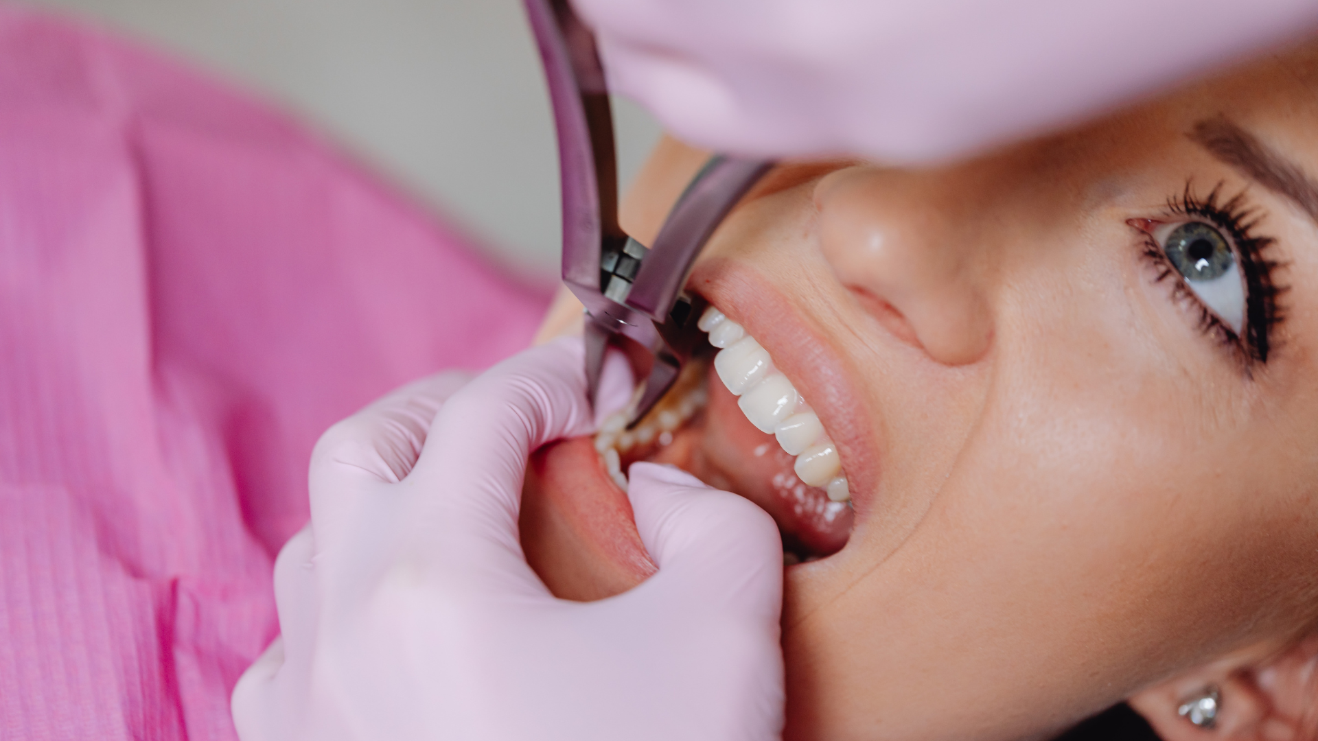 Dentist using tools to examine a patient’s mouth, with pink gloves and bib in a dental chair