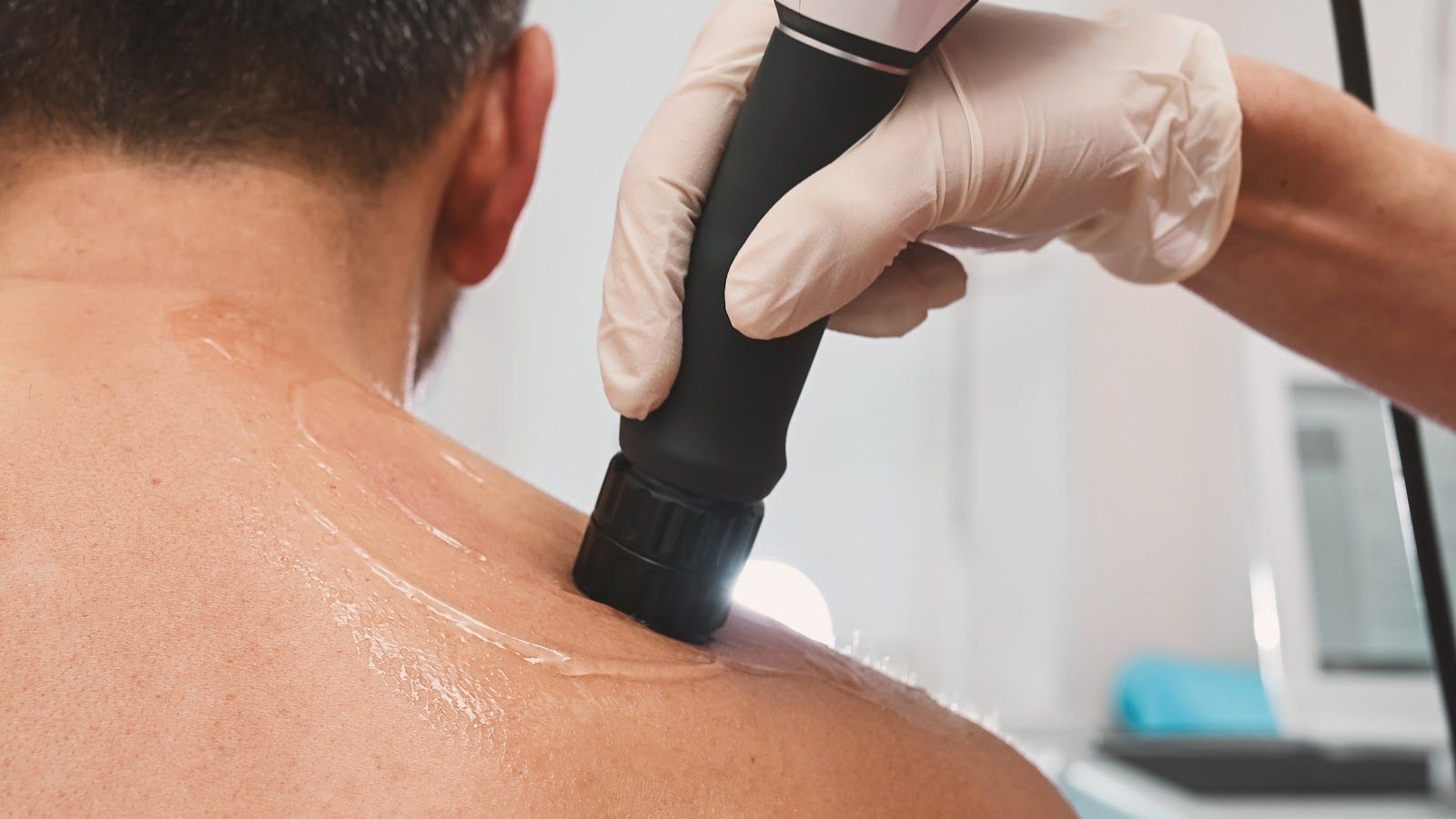 Gloved clinician using a handheld device on a patient’s upper back during a skin treatment