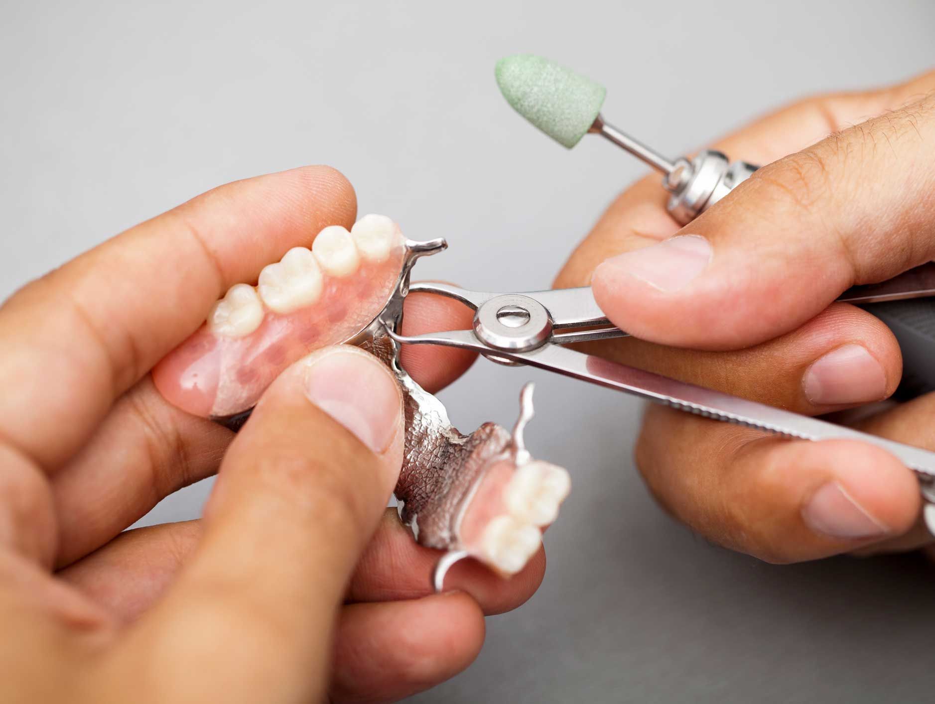 Partials — Fairbanks, AK — Barrera Dental, PC