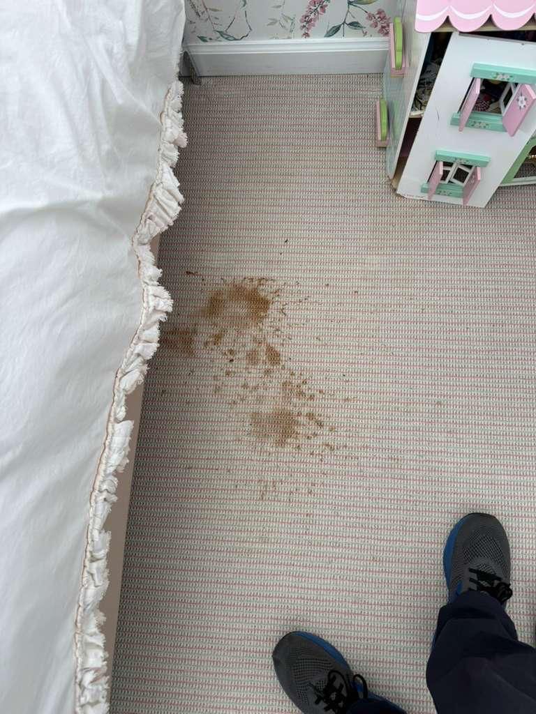 Carpet with a brown stain beside a bed, with a person’s shoes visible at the bottom right.