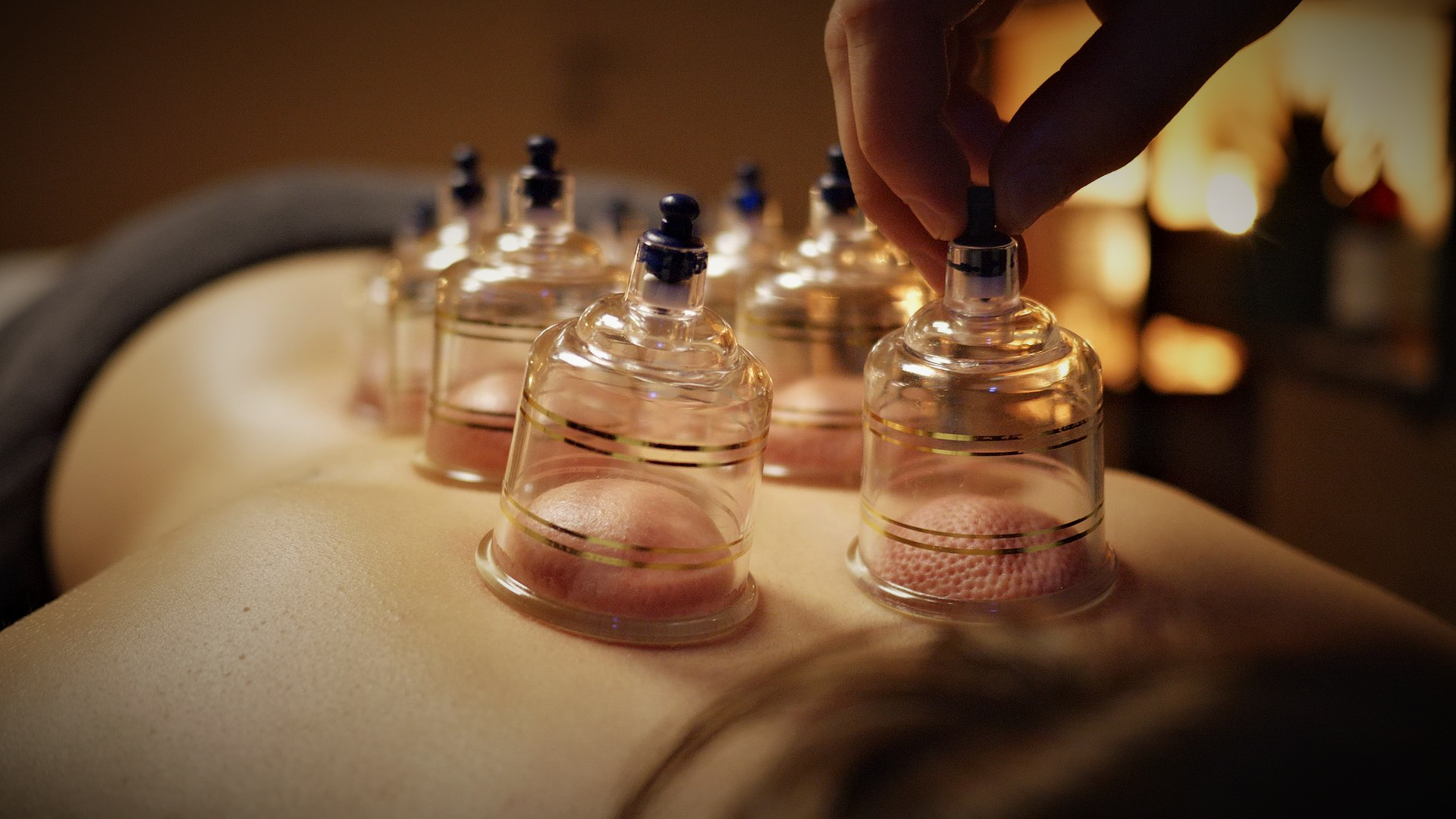 Enjoying the best body cupping at Aurah spa in Prestwick, Ayrshire