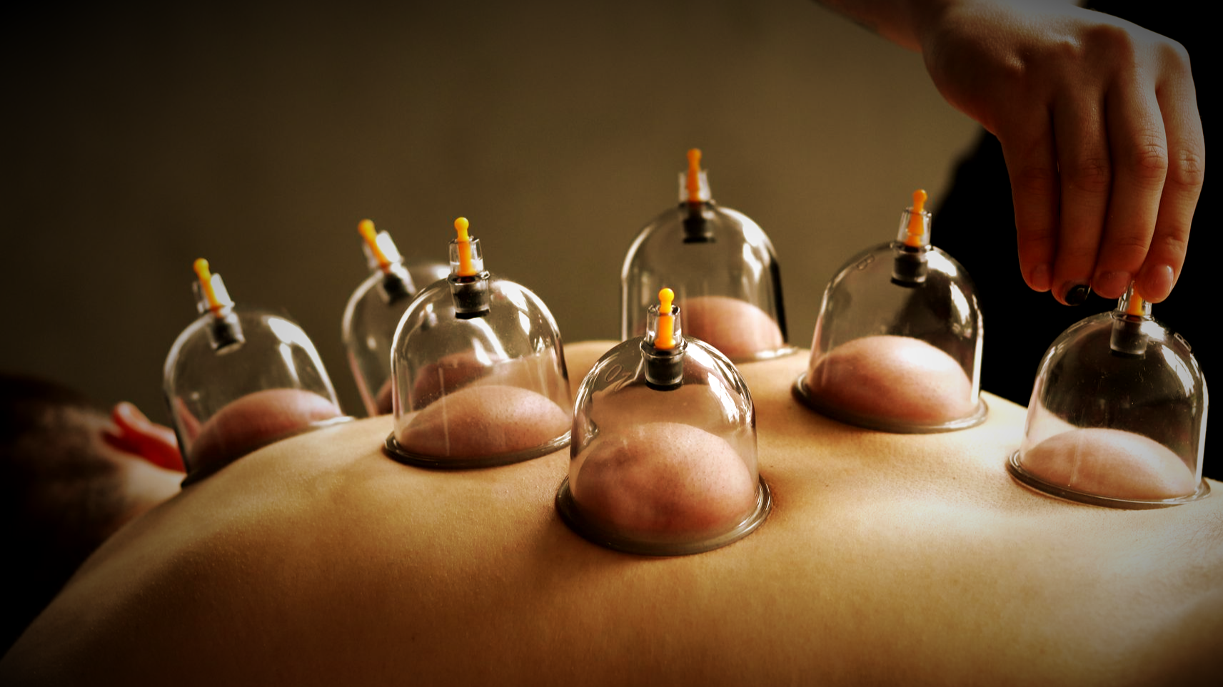 Relaxing body cupping at Aurah spa in Prestwick, Ayrshire