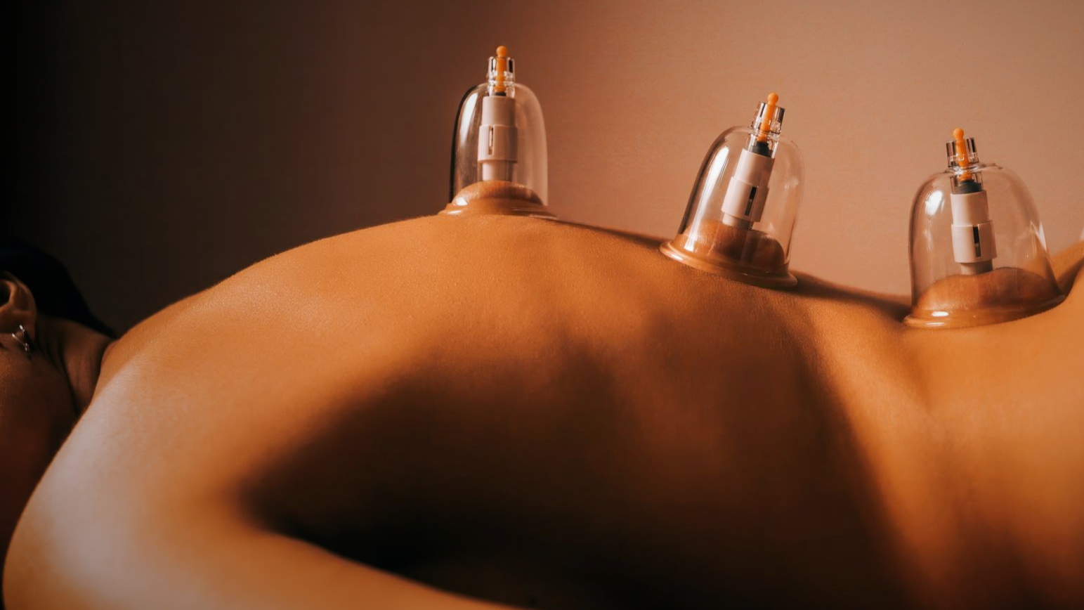 Aurah in Prestwick explores how body cupping