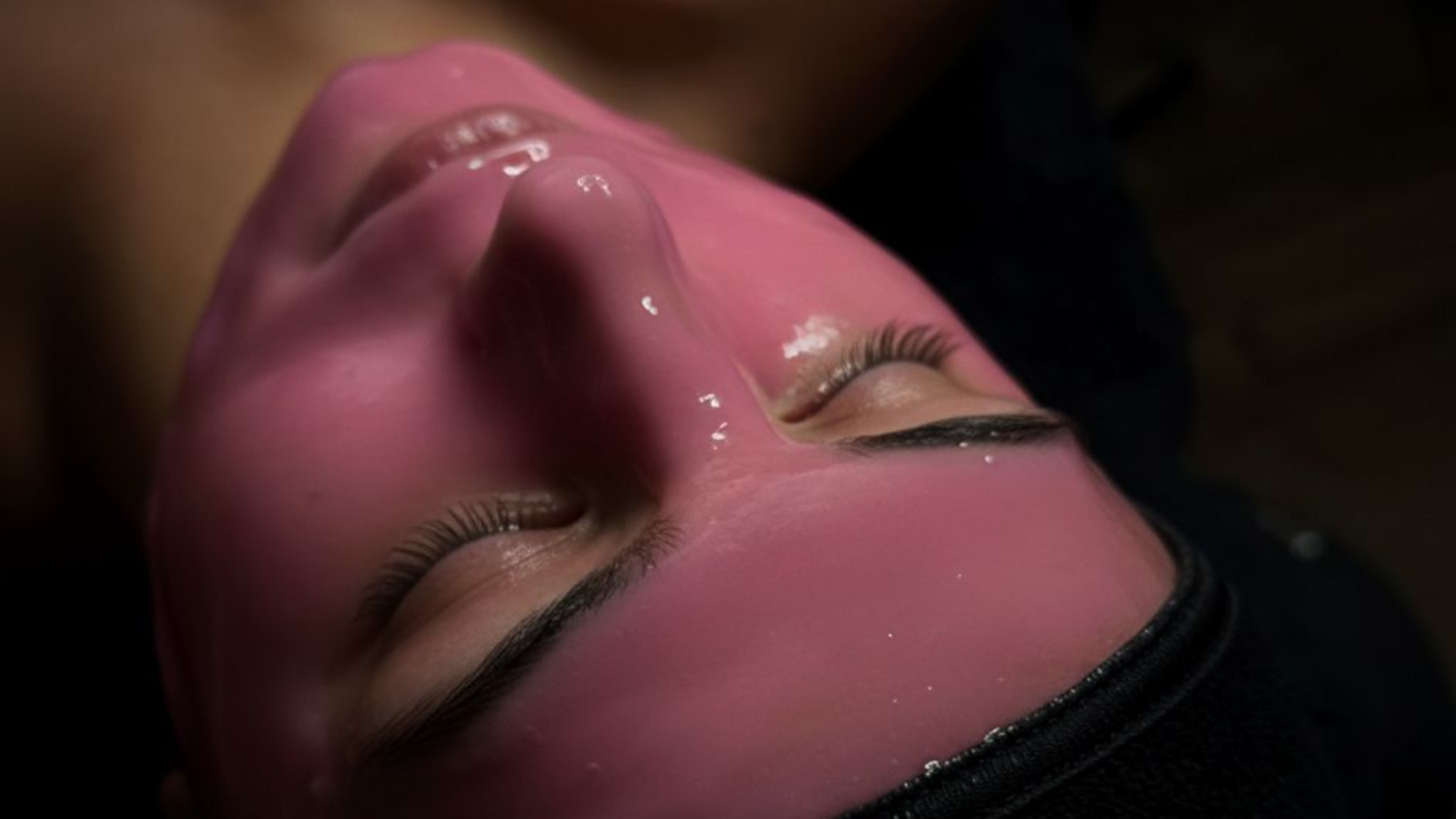 Acne skin treatments at Aurah spa near Troon