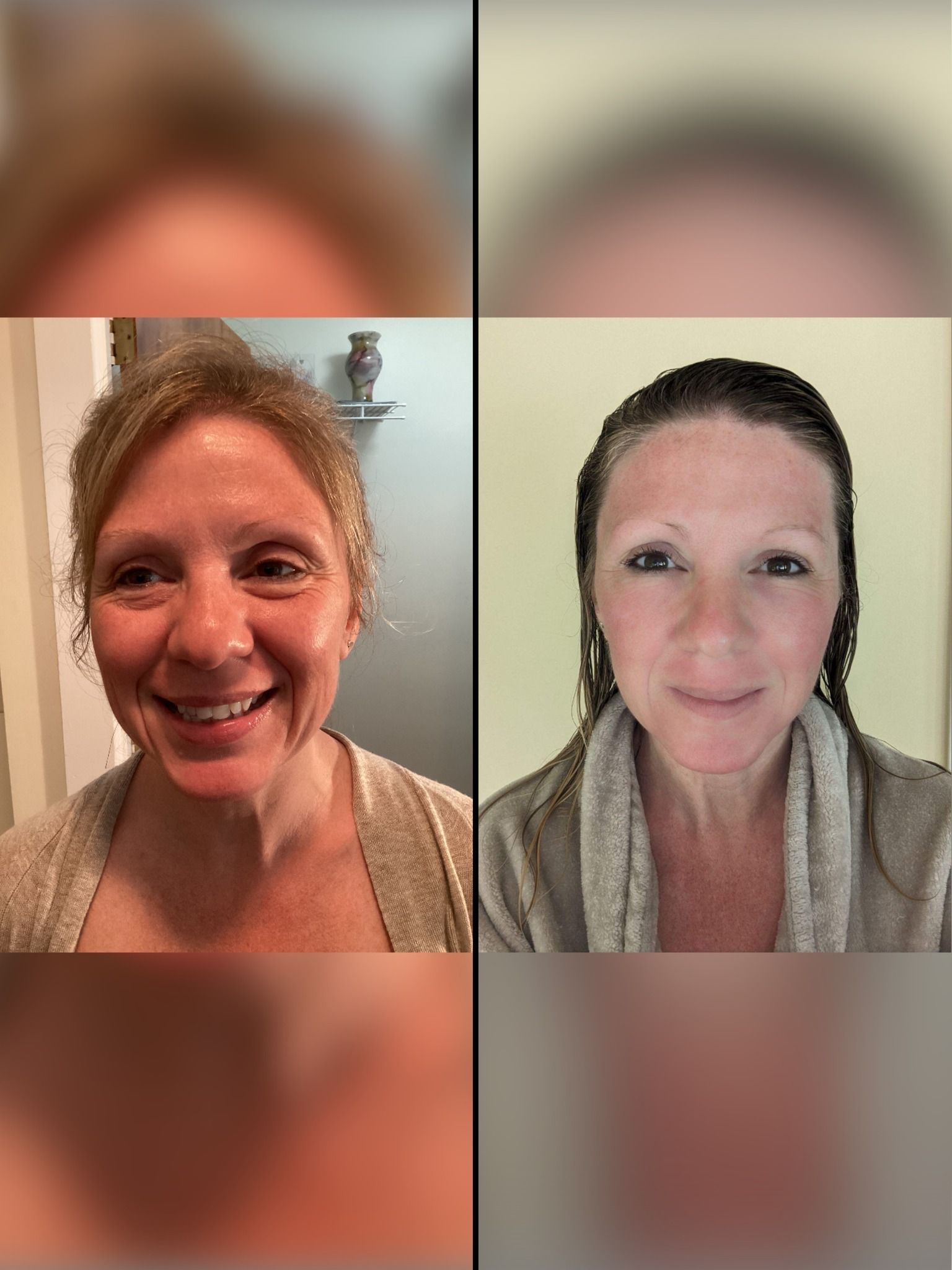A before and after picture of a woman 's face.