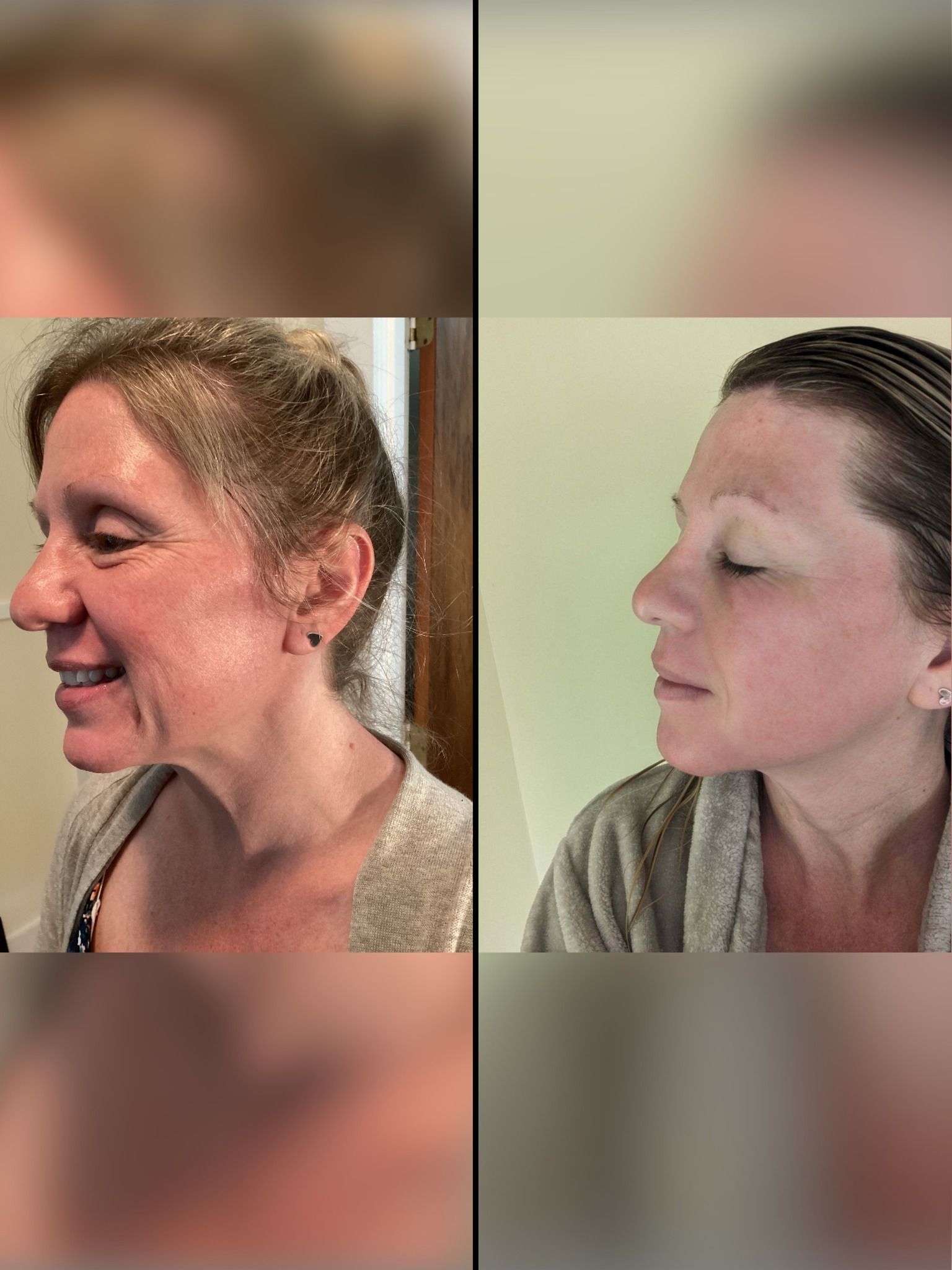 A before and after photo of a woman 's face.