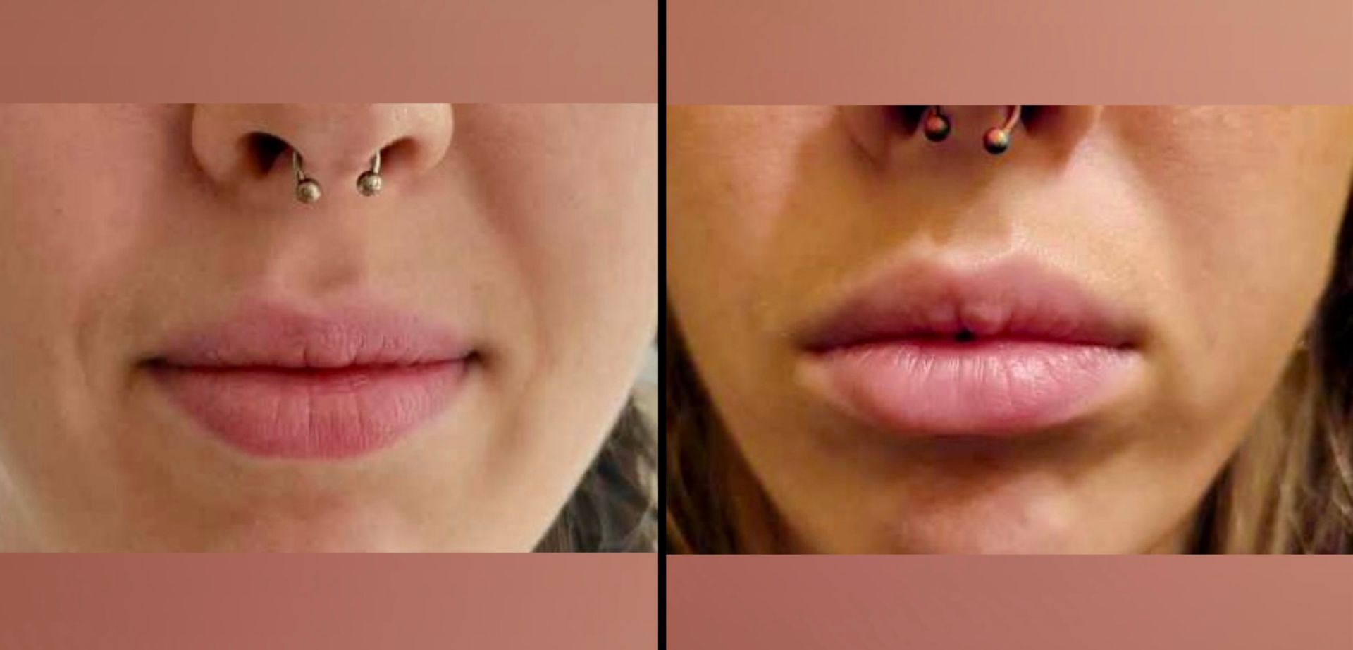 A before and after photo of a woman 's lips with a nose ring.