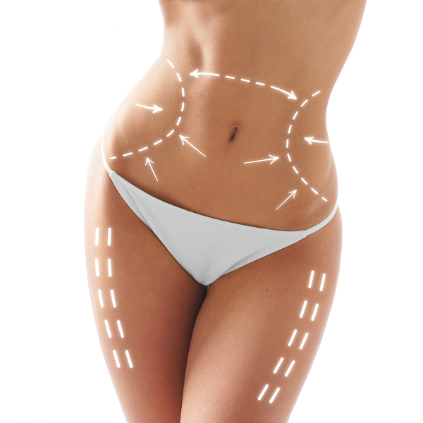 Una donna in biancheria intima bianca ha delle frecce disegnate sul busto e sulle gambe