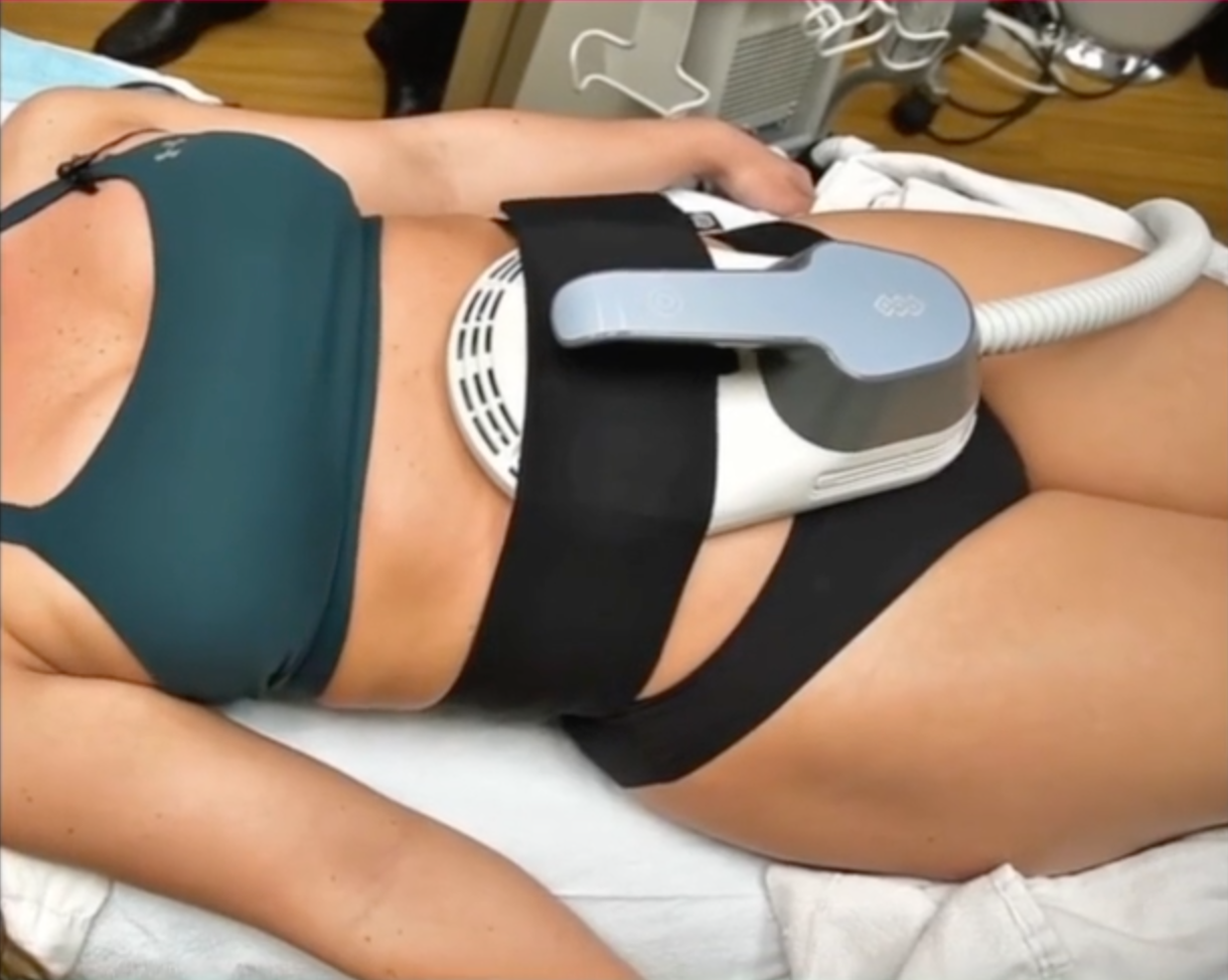 Una donna è sdraiata su un letto con un dispositivo sulla pancia