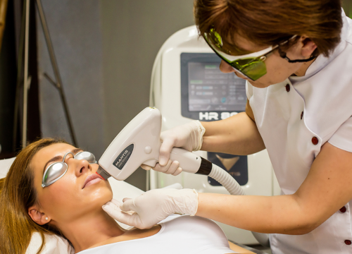 laser donna baffetto Una donna sta ricevendo un trattamento di depilazione laser sul viso.