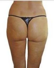 Una donna indossa un perizoma nero su sfondo bianco.