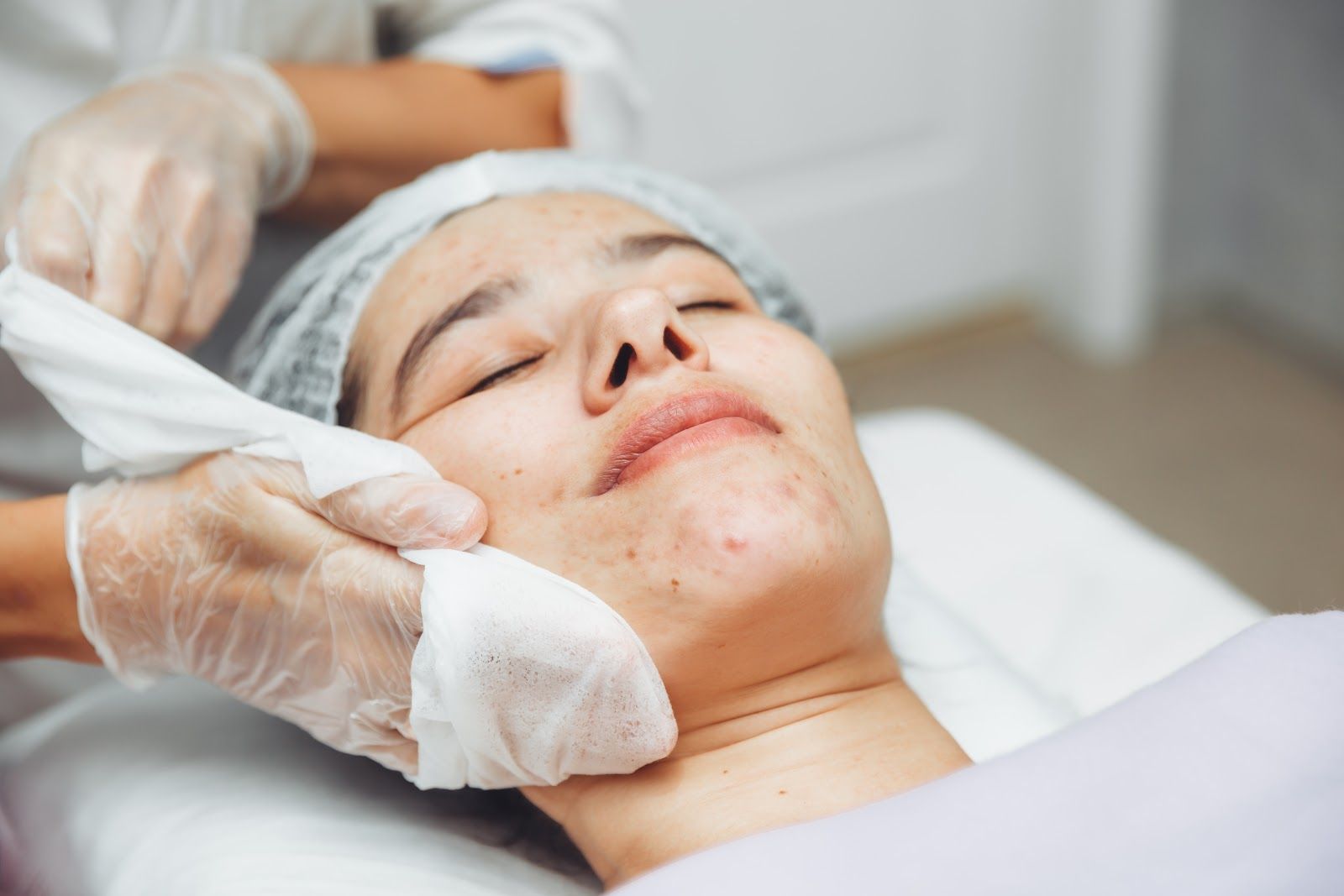 Gloved hands wiping lotion from a person’s face during a facial treatment