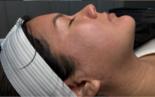 Close-up of a person lying on their side with a white headband, eyes closed, in a spa setting