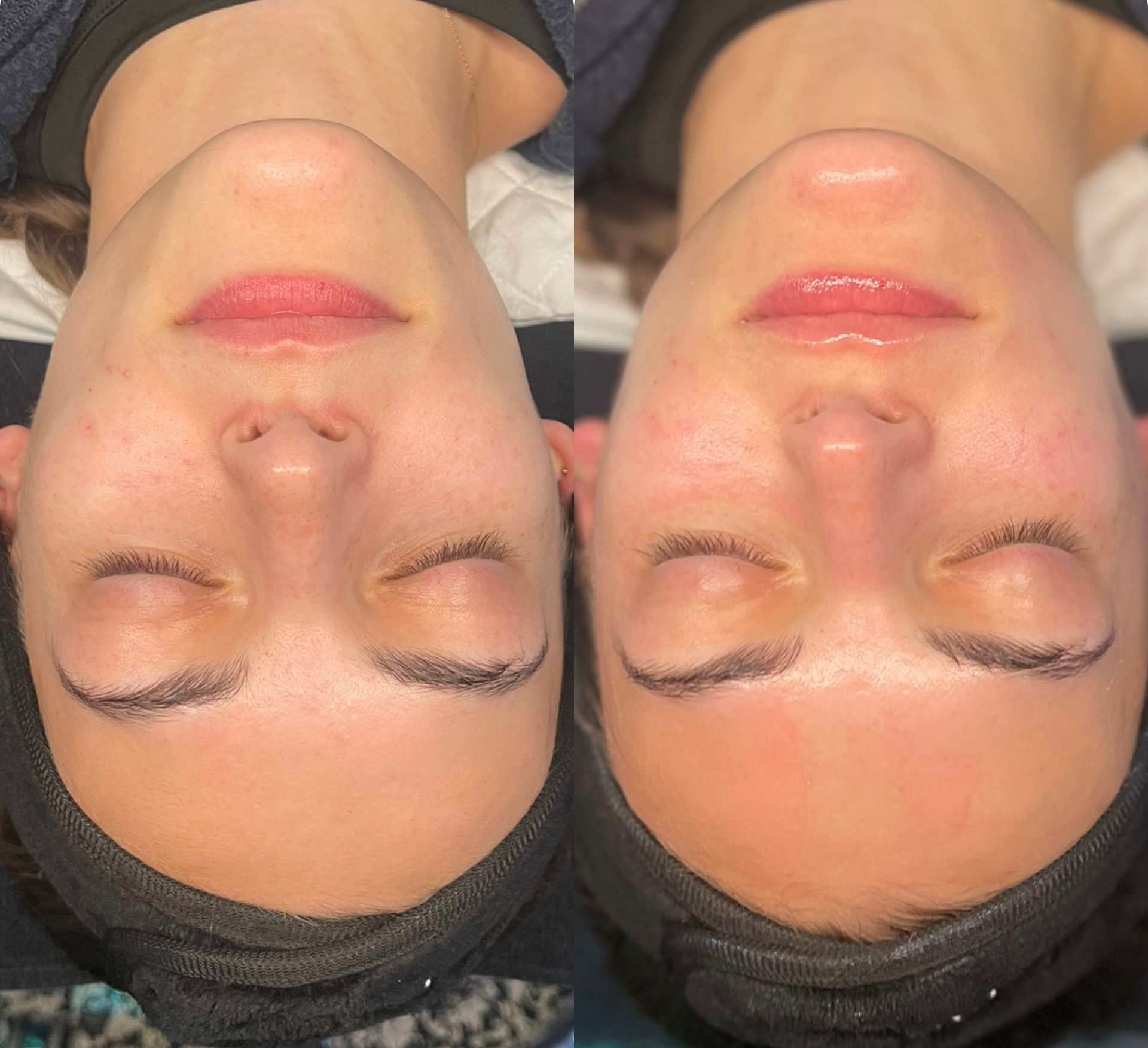 Two upside-down faces side by side with closed eyes and black head coverings