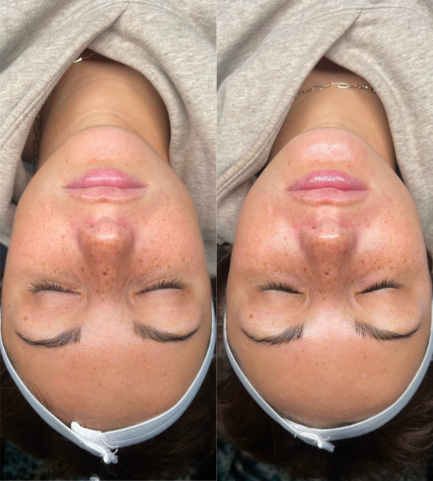 Side-by-side close-up of a person lying down with eyes closed, wearing a light headband.