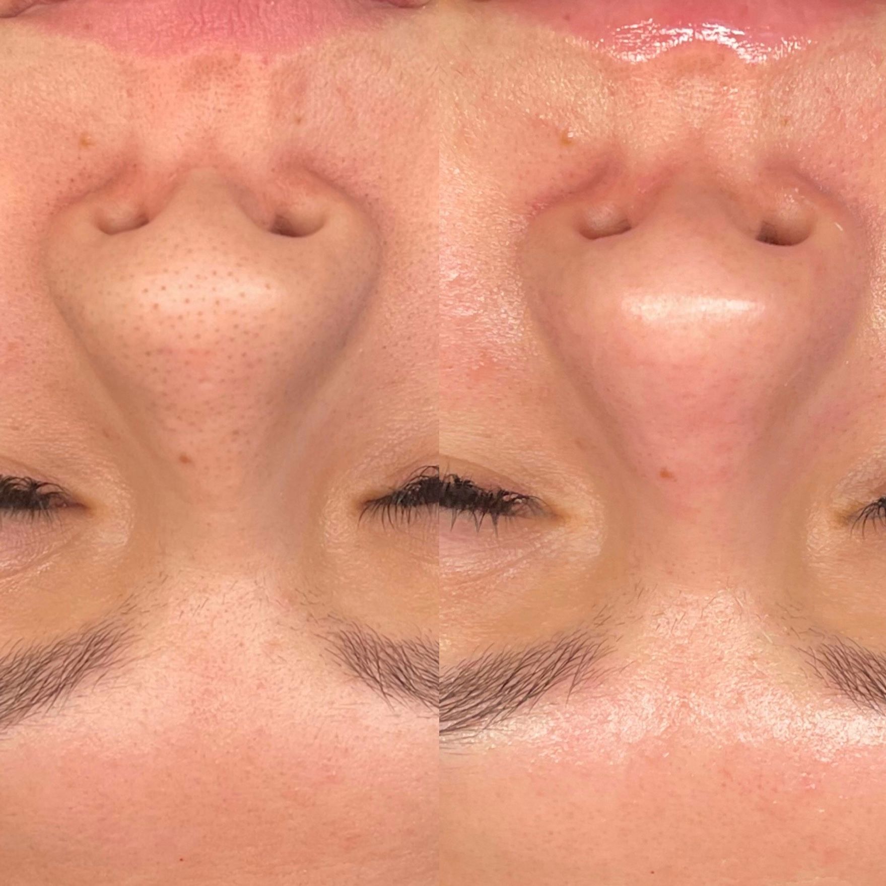 Mirrored close-up of a face with two noses and closed eyes, shown upside down