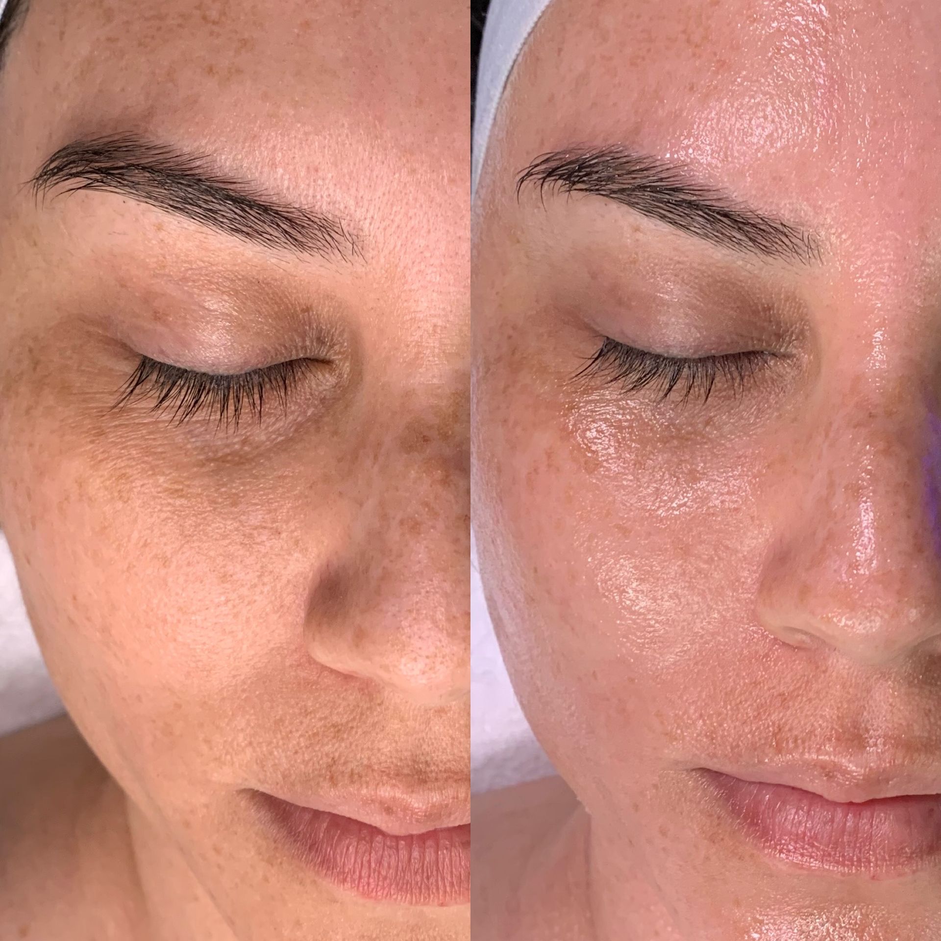 Side-by-side close-up of a face before and after skincare, showing brighter, more moisturized skin.