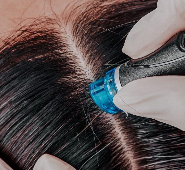 Scalp treatment device parting dark hair, showing close-up of a blue applicator on the scalp