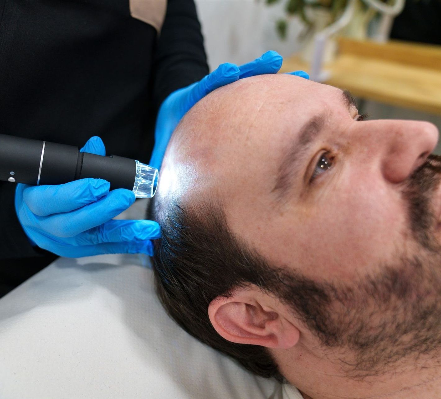 Scalp treatment with a handheld device on a man lying on a bed, wearing blue gloves
