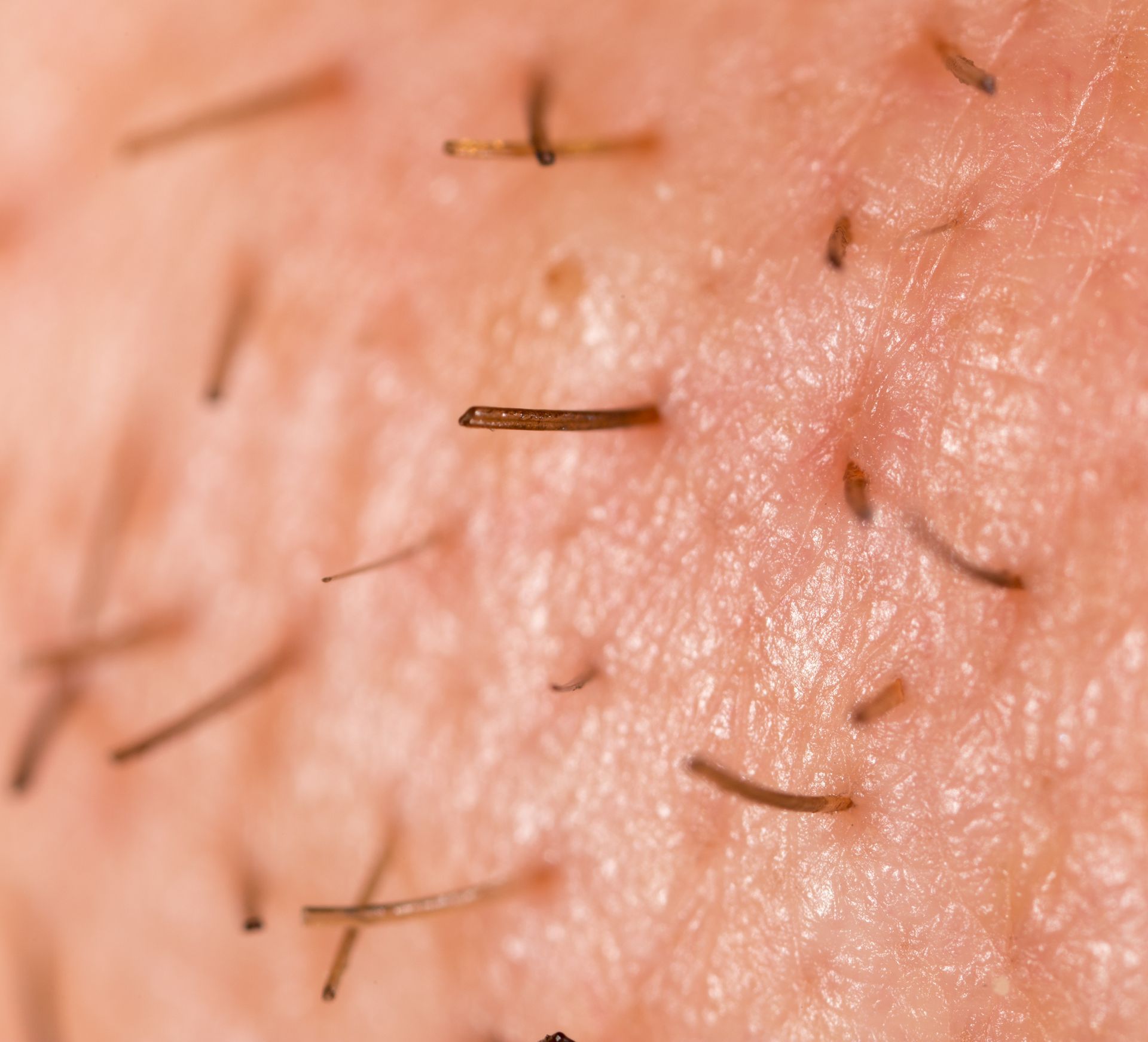 Close-up of skin with several short hairs and small dark spots