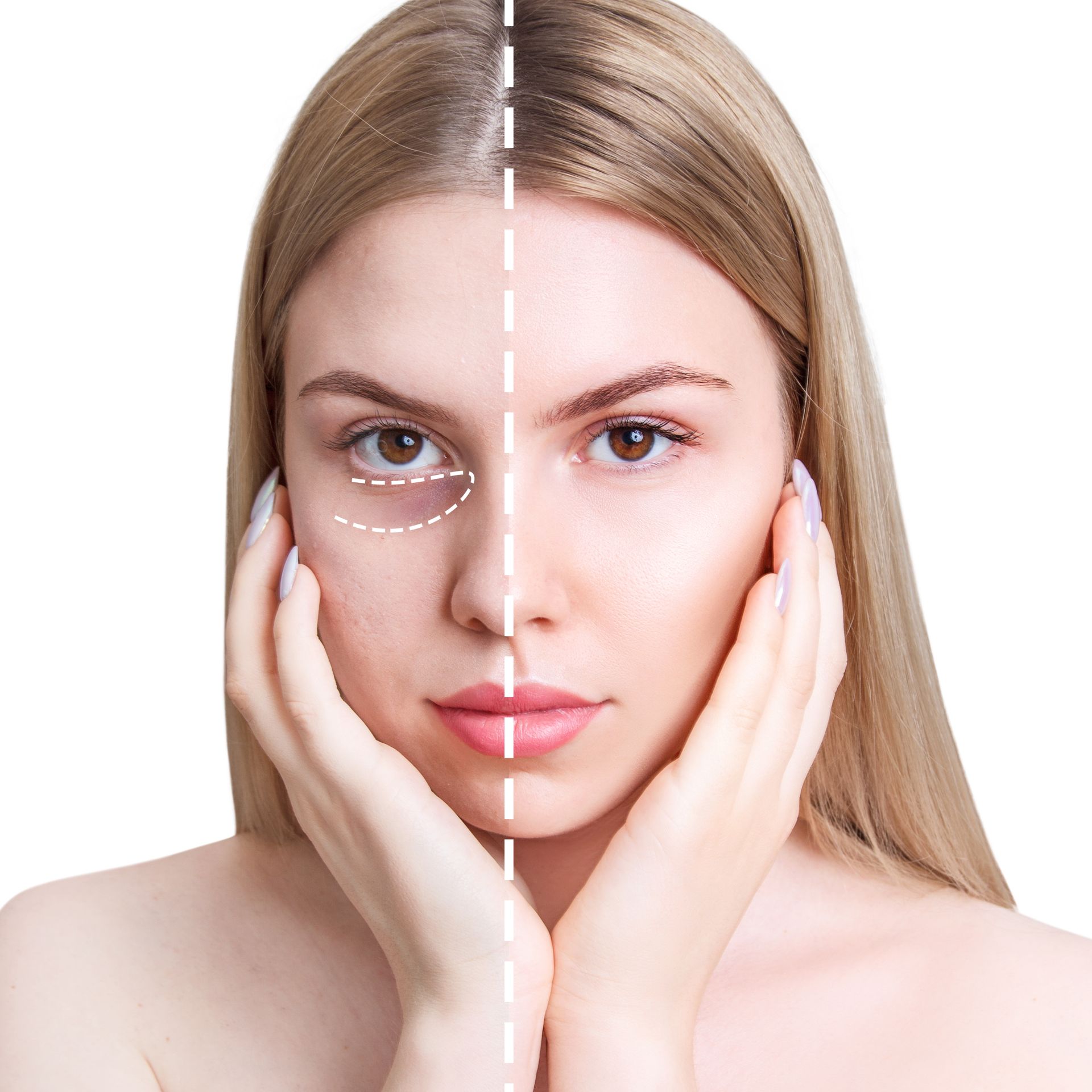 Split-face portrait of a woman with one side natural and the other smoothed by a dashed line overlay