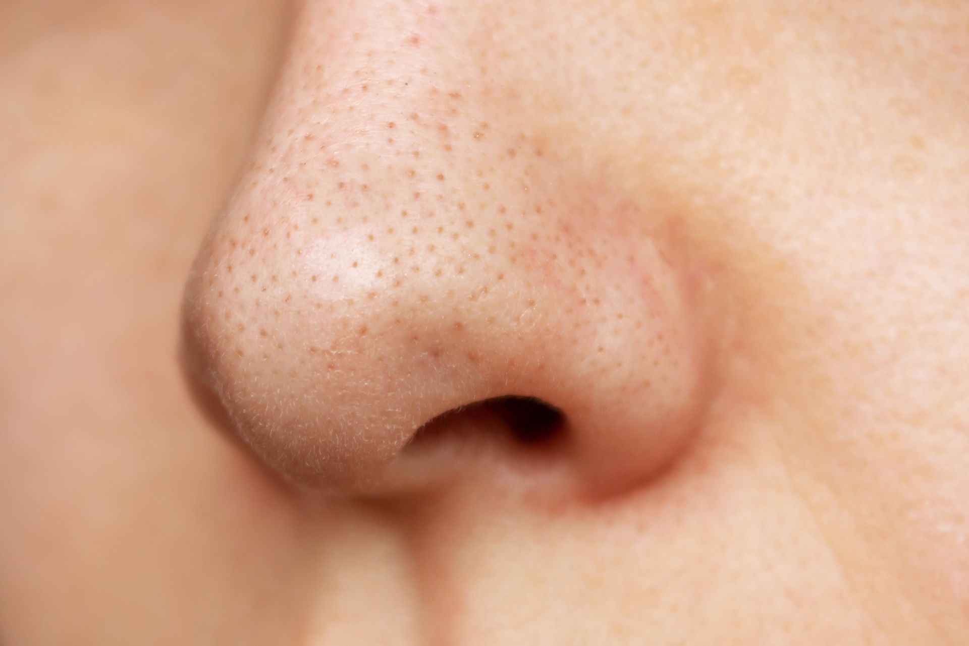 Close-up of a human nose with visible pores on light skin.