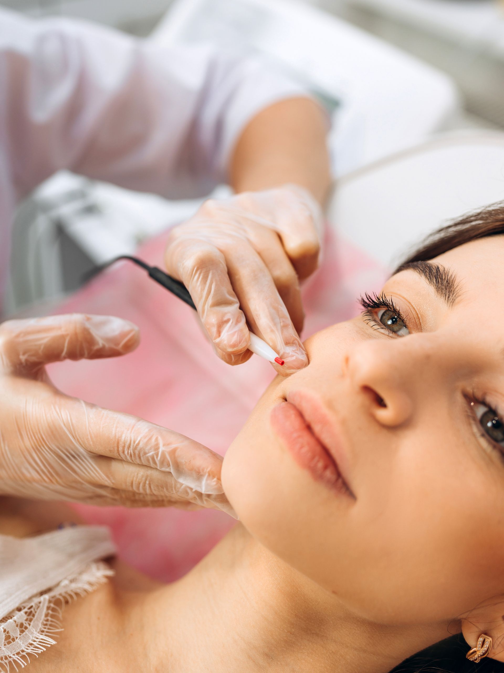 Cosmetic procedure on woman’s face as gloved hands apply treatment near her eye and cheek