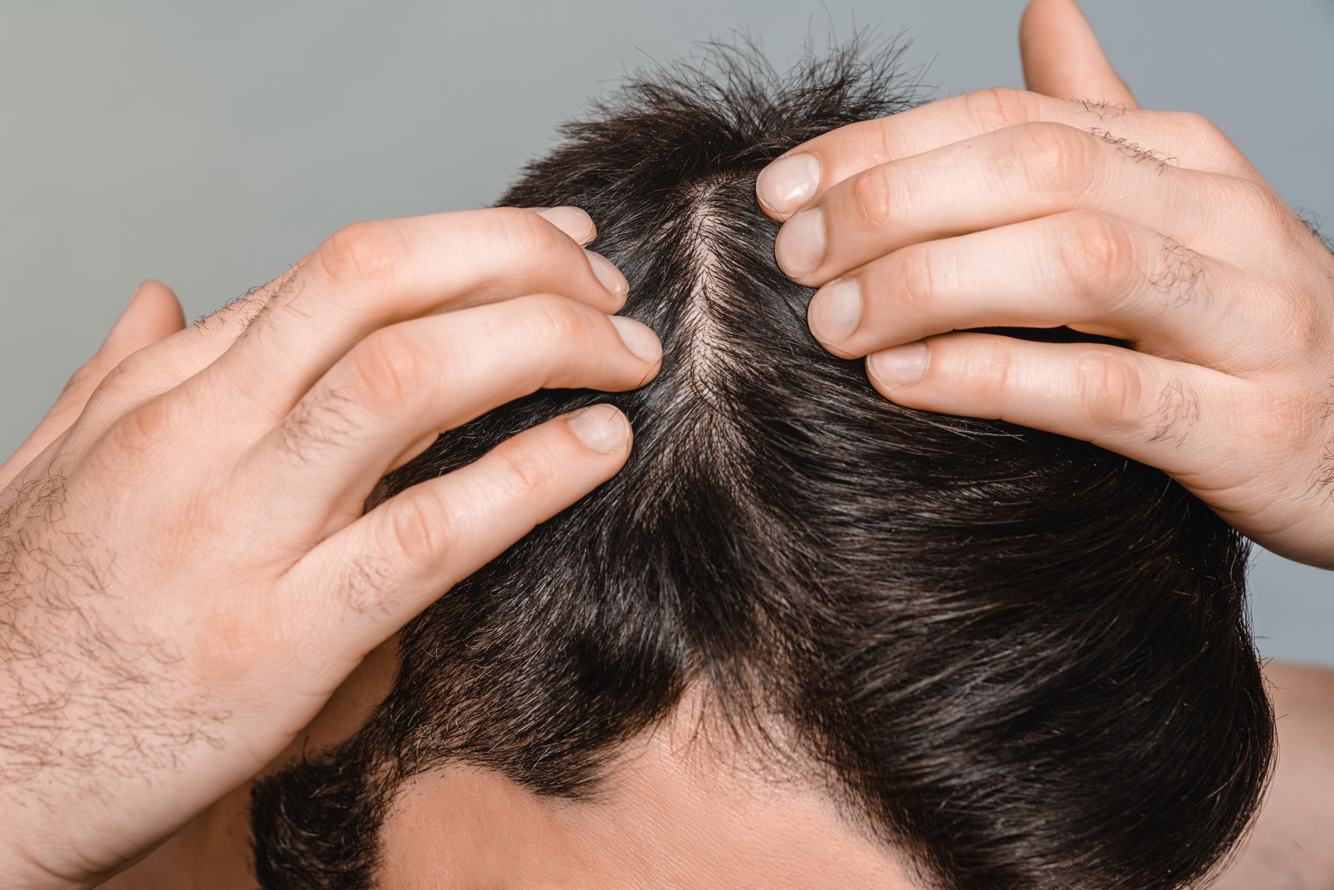 Hands parting dark hair to expose a scalp line in the center of the head
