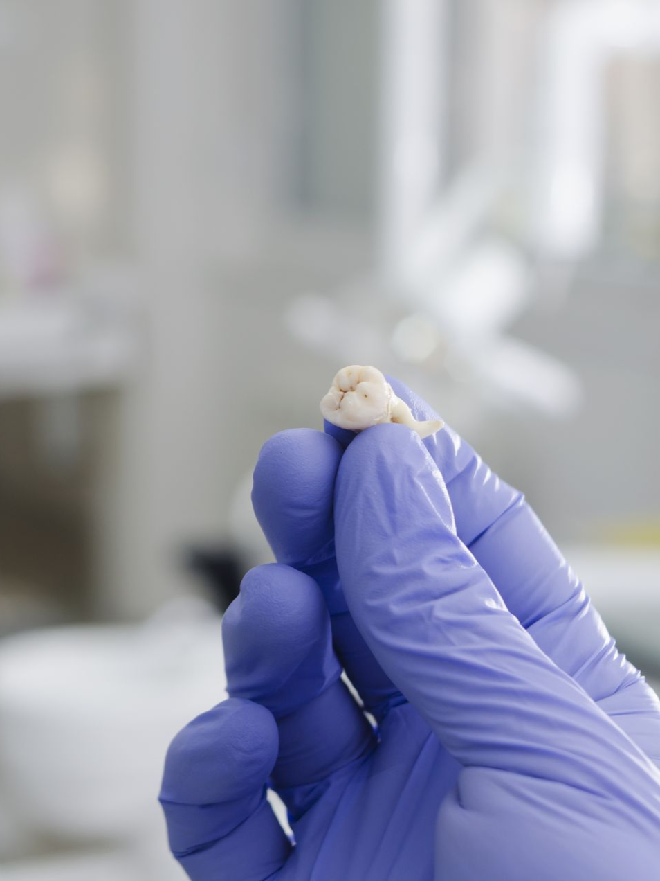 Gloved hand holding a small tooth in a clinical setting