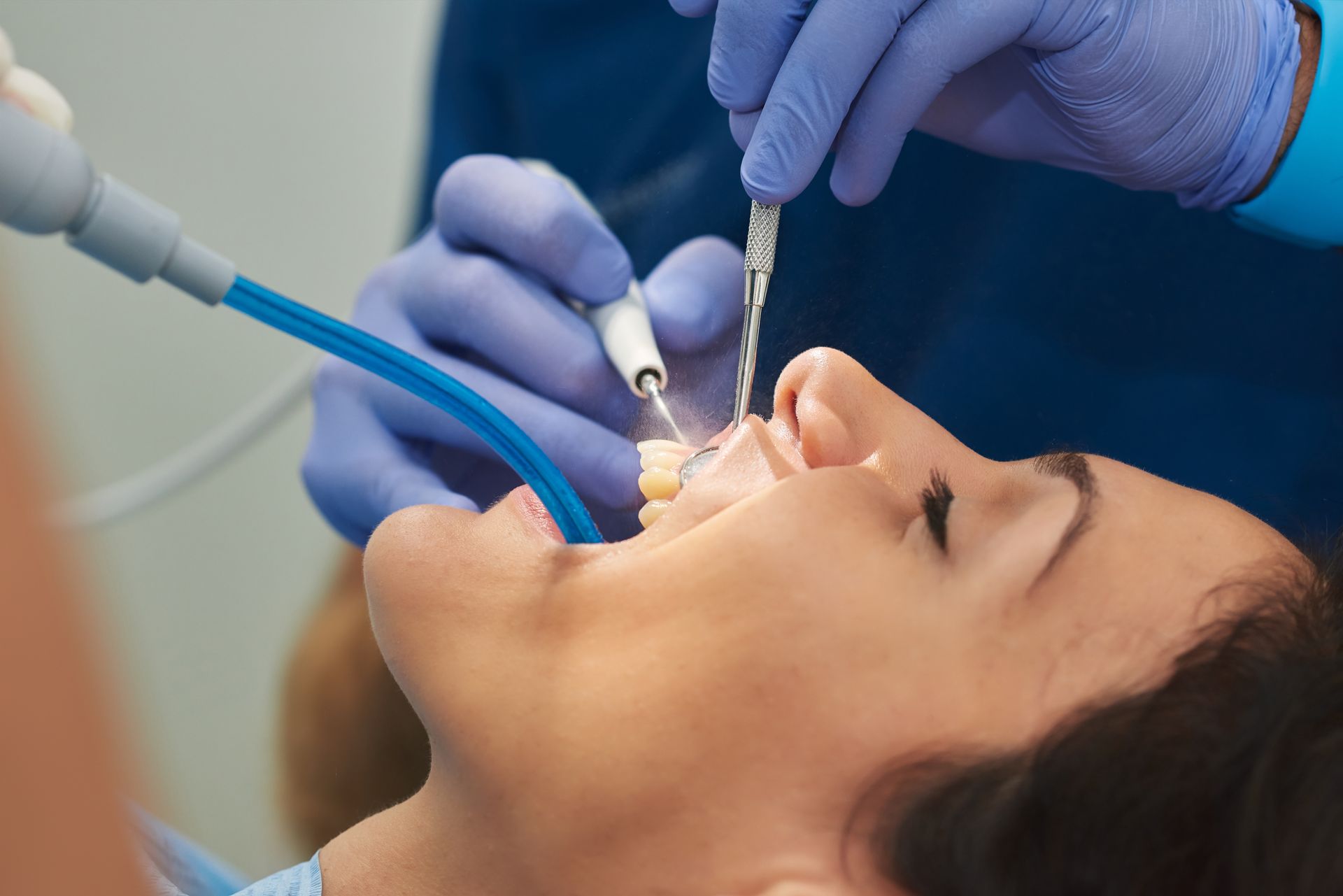 Dental procedure with gloved hands using tools on a patient’s open mouth