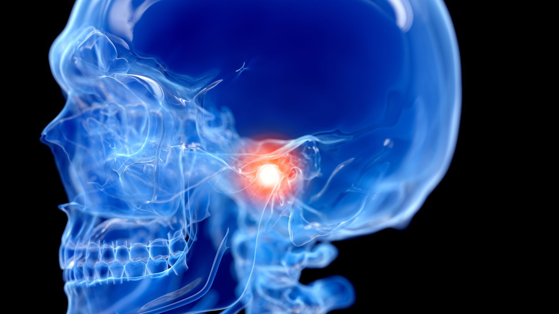 Blue skull X-ray with a glowing red spot near the temple, suggesting head pain or injury