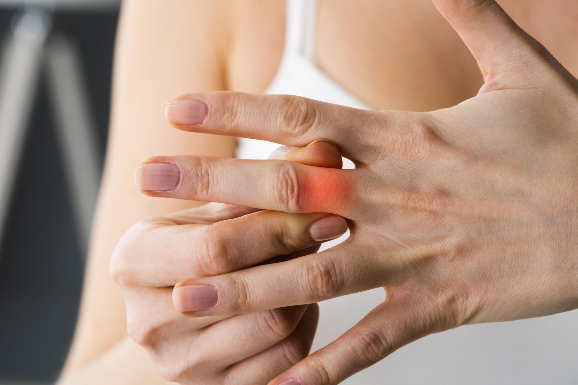 Hands clasping a finger with a red, painful-looking joint area