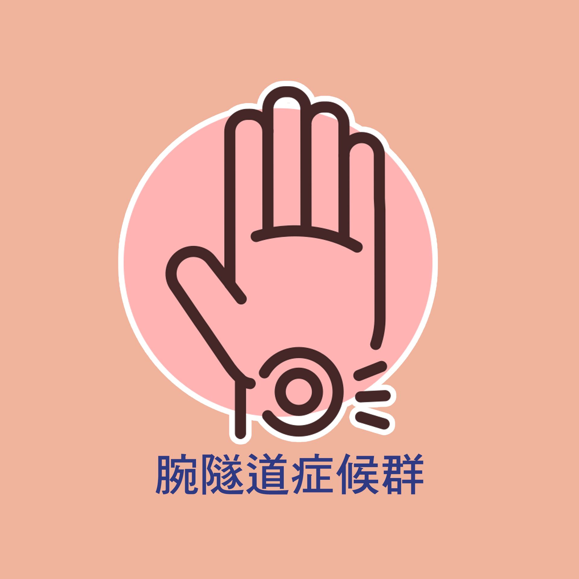 腕隧道症候群