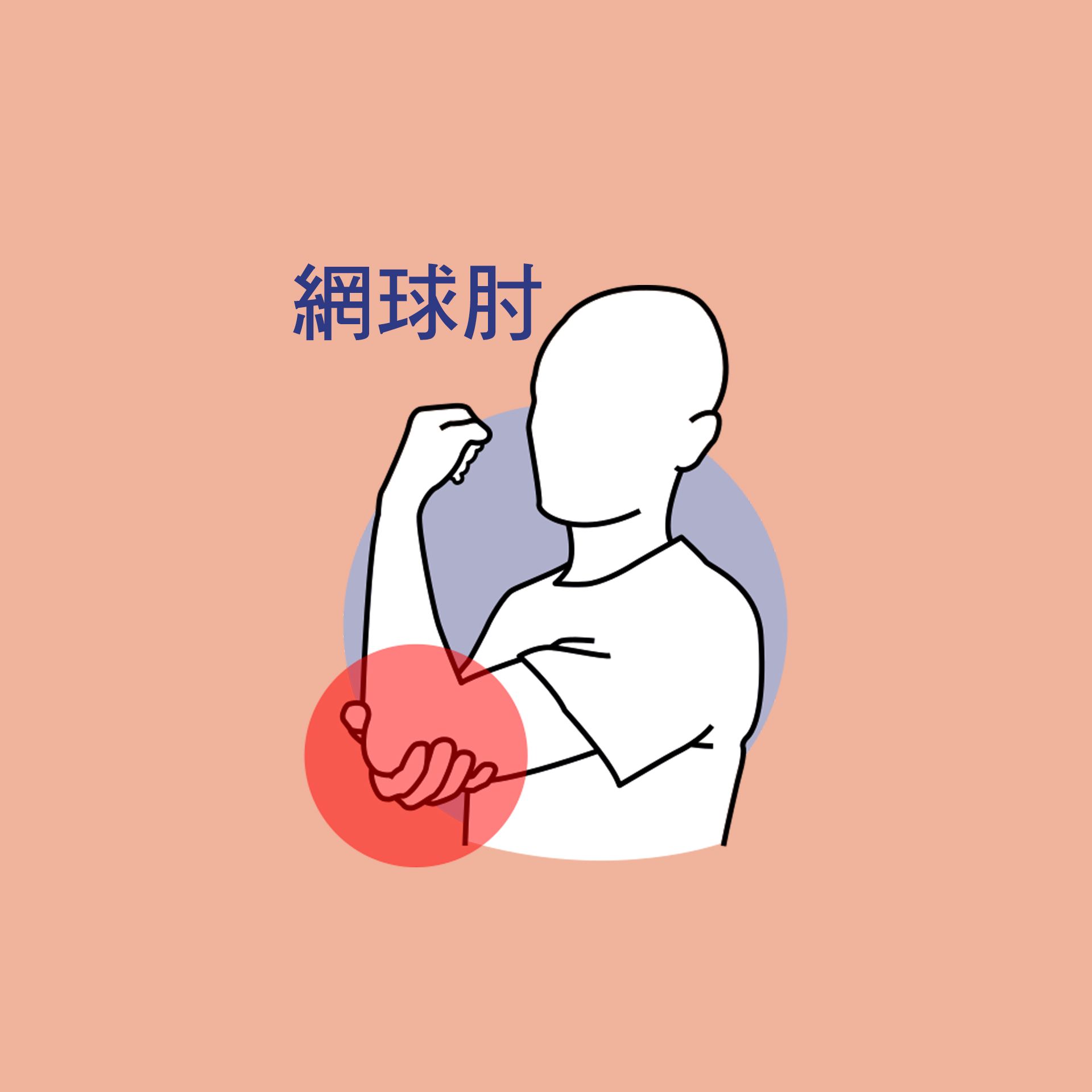 網球肘