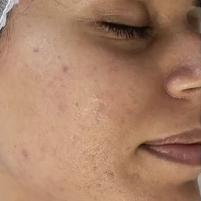 Frauengesicht mit sichtbaren Poren, einigen Schönheitsfehlern und geschlossenen Augen.
