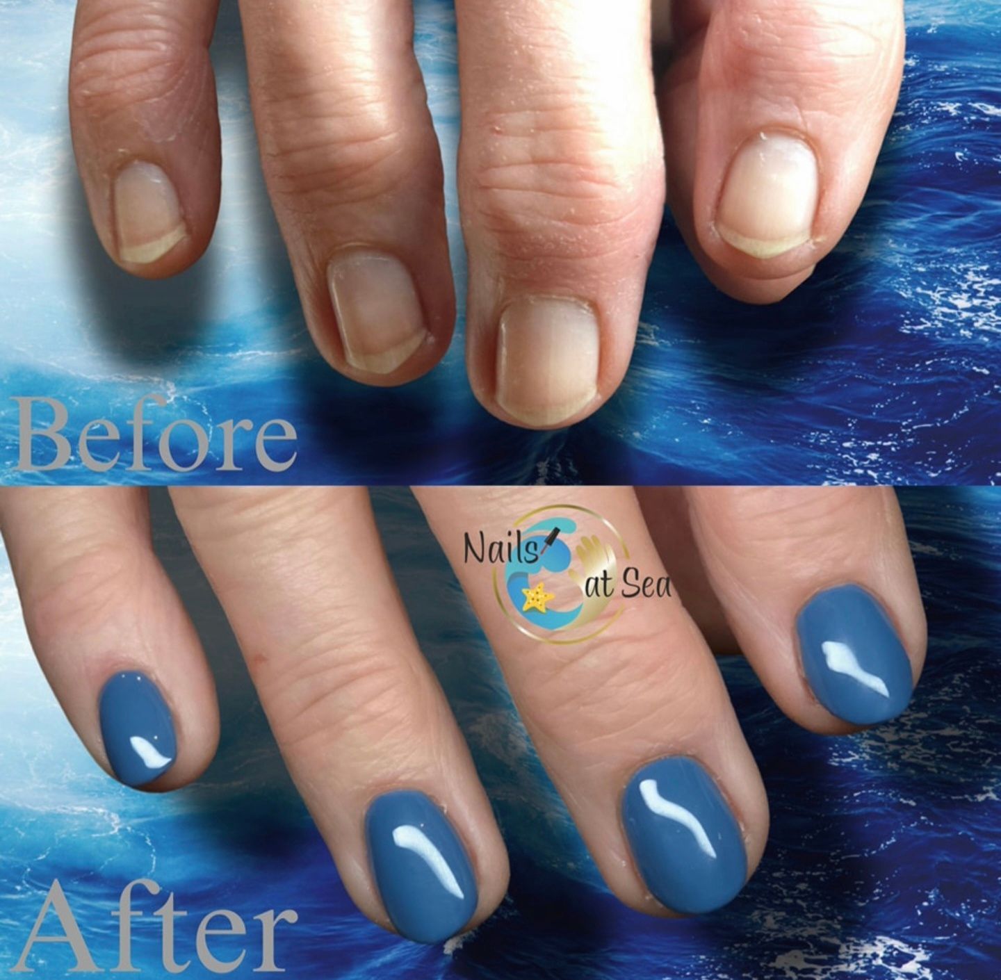 Voor en na vergelijking van vingernagels: boven zie je onbehandelde, natuurlijke nagels en onder zie je nagels die effen, glanzend blauw zijn geverfd.