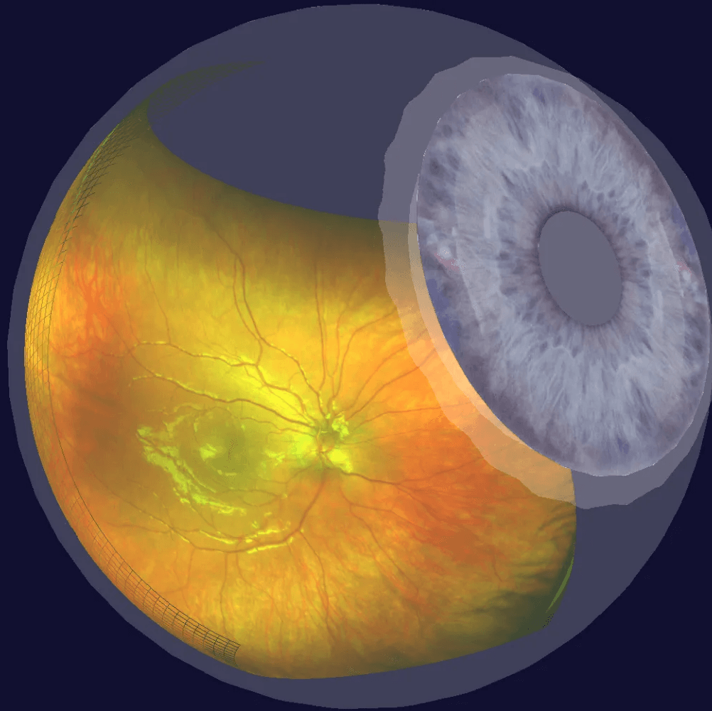Optomap | Grass Valley, CA | Grass Valley Eyecare Optometric Inc.