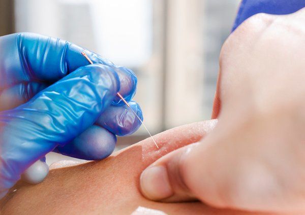 Gloved hand giving a finger prick blood test on a person’s finger