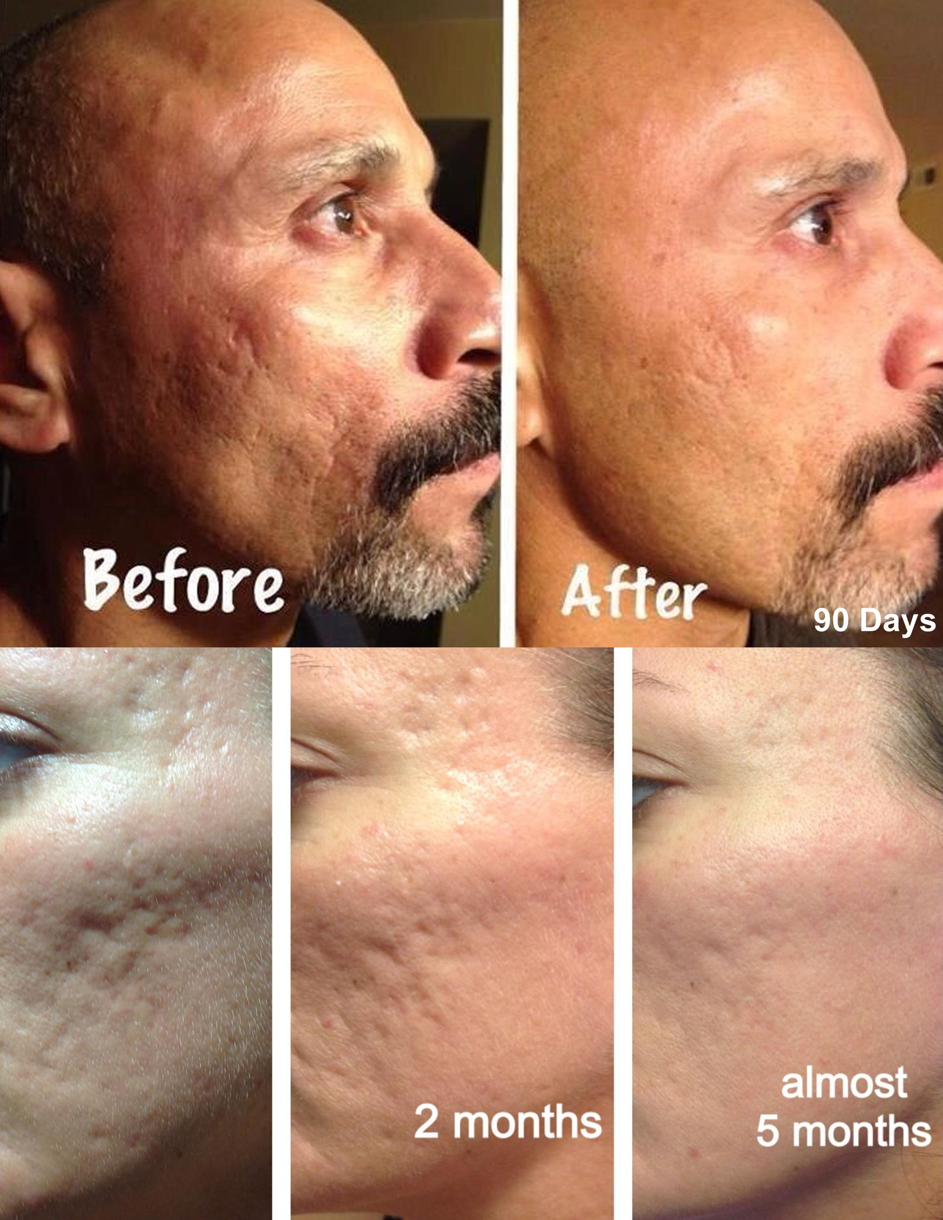 Nerium Night Cream