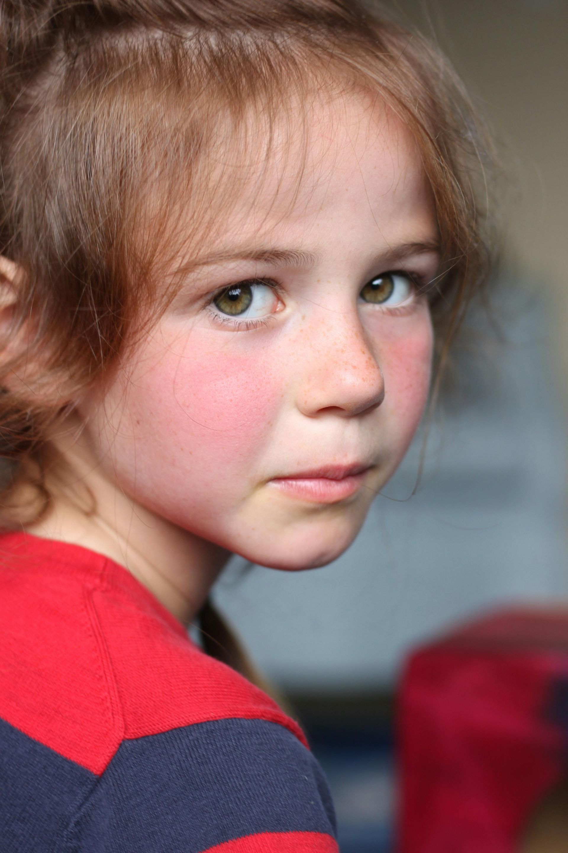 Young girl with reddish hair, freckles, and rosy cheeks looking directly at the viewer, wearing a red and blue striped shirt.