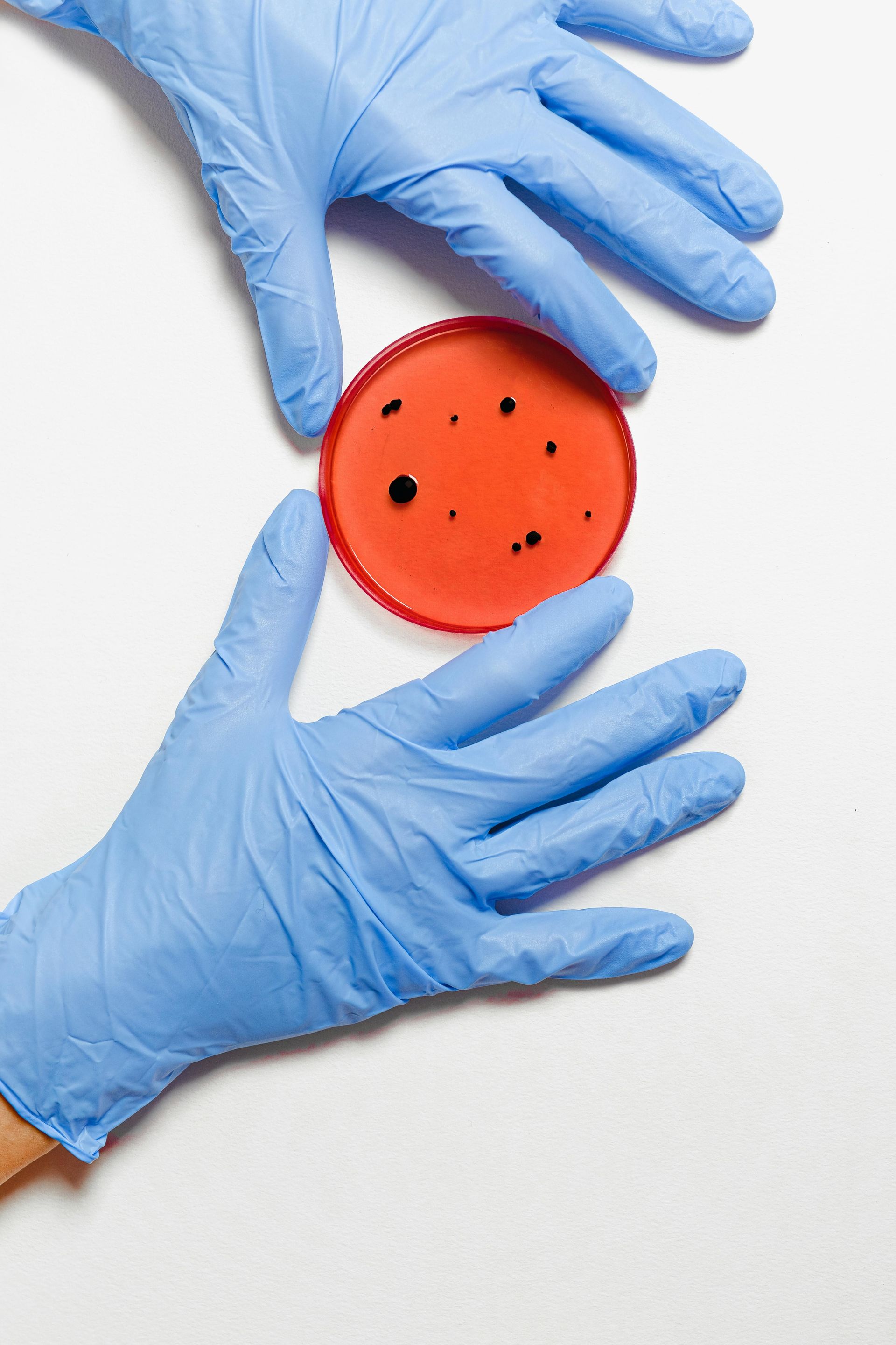 Hands in blue gloves holding a petri dish with red agar and dark spots.